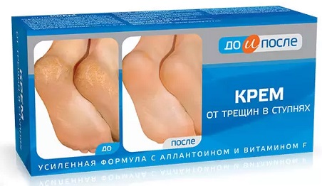 До и После крем от трещин в ступнях, 50мл