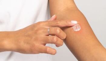 Лучшие обезболивающие мази