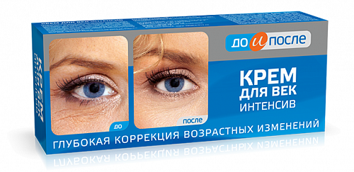До и После крем интенсив для век, 30мл